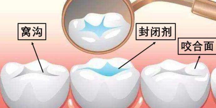 哪些人不适合进行牙齿整形？了解这些常识后再做决定！