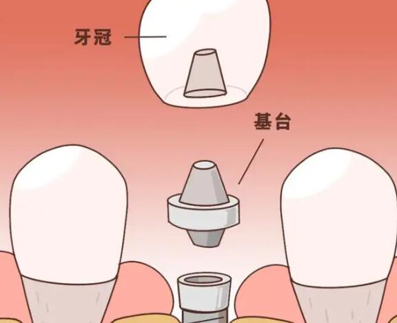 全国推荐的口腔医院TOP5，汇总带你找到比较好的口腔医院