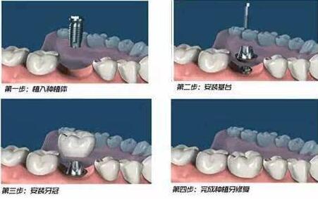 南京医疗口腔诊所排名推荐，性价比高的医院有哪些？