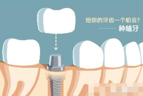 南京牙齿矫正医院评价，美奥与金铂利比较