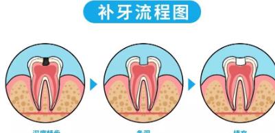 徐州地区牙齿矫正医院TOP 5！专业推荐，德贝、美奥价格公开！