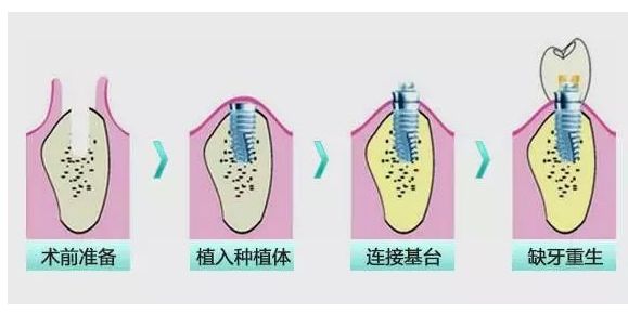 昆明市五家好评如潮的口腔医院盘点