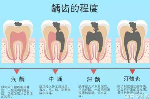 上海种牙医院哪家靠谱？排名前十家值得选择！