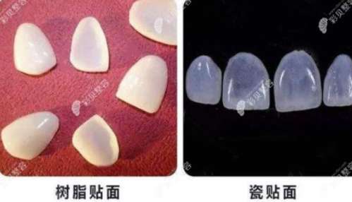 北京口腔医院排名揭晓，中诺、维乐等品牌震撼呈现！