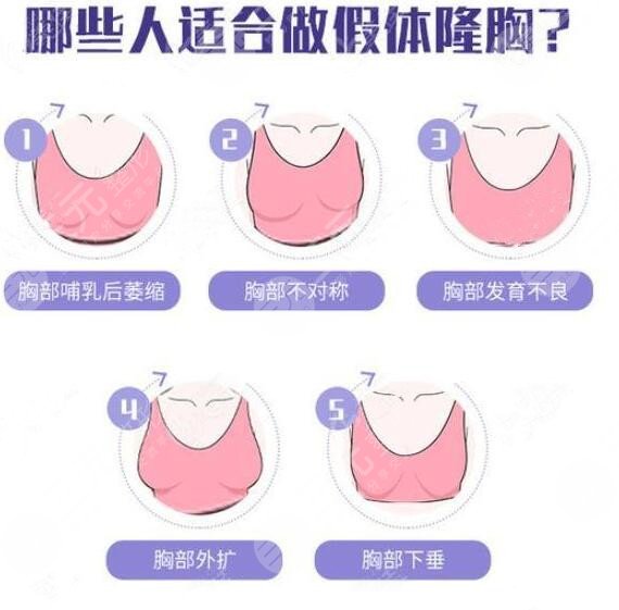 深圳北大医院假体隆胸怎么样?