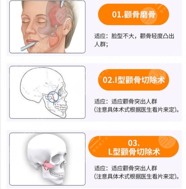 下颌角整形手术不适人群