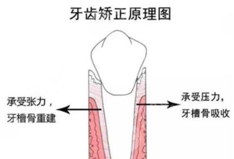 大连市**口腔医院科普牙齿矫正原理