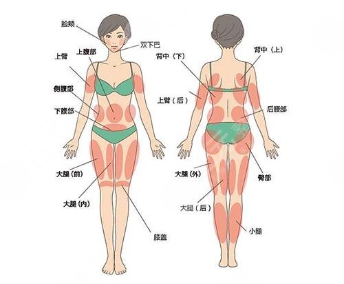 吸脂减肥的原理是什么?