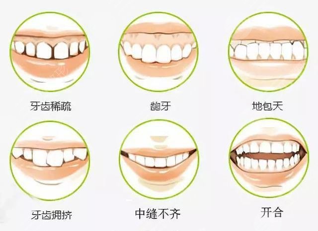 温州医科大学附属第一医院牙科擅长项目科普:牙齿正畸