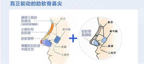 假体隆鼻手术