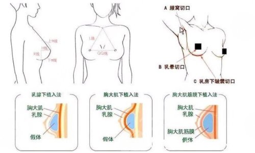 上海东方医院整形科擅长项目介绍