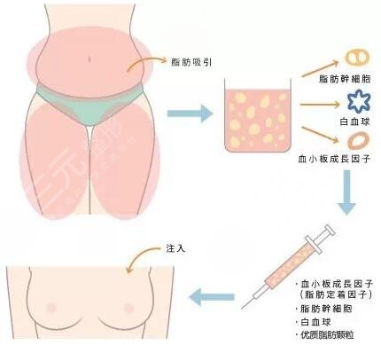 芜湖伊莱美整形外科医院崭新价目表曝光