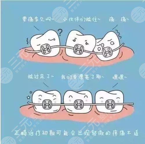 四川省第二人民医院口腔科牙科牙齿矫正案例：术后