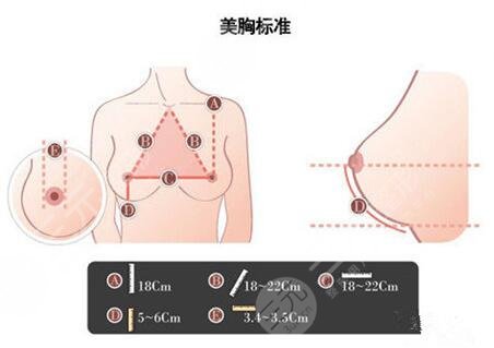 上海亚铂整形医院隆胸案例