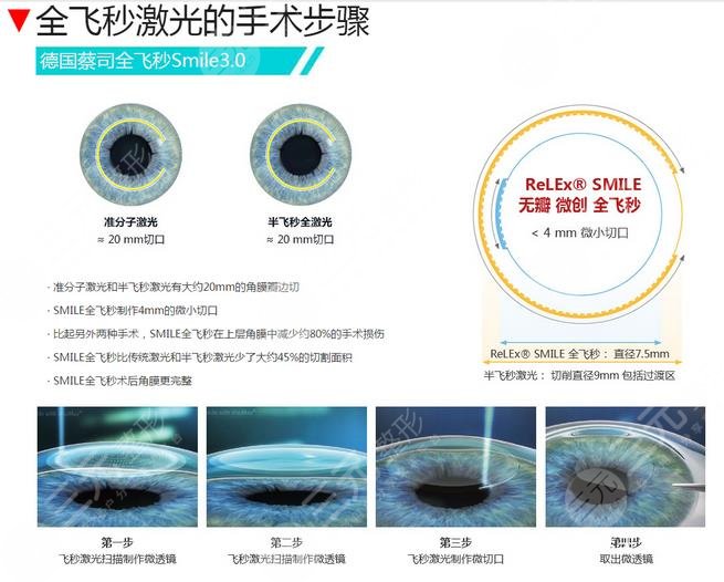 近视眼做激光手术有果吗