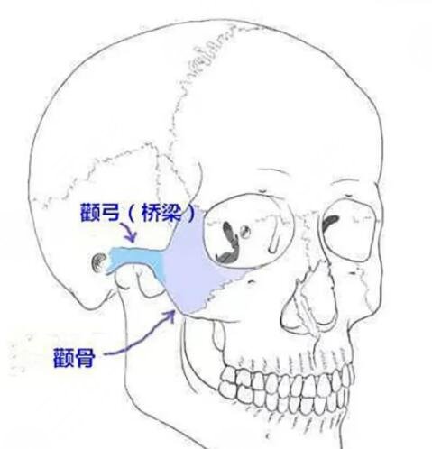 颧骨整形术的恢复时间是多久