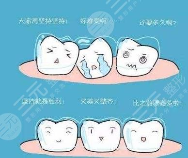 北京优贝口腔医院隐形矫正相关介绍