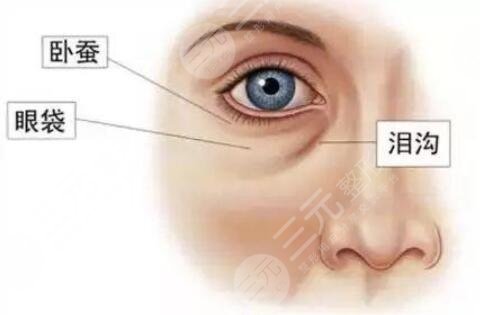 内切去眼袋的技术特点在哪