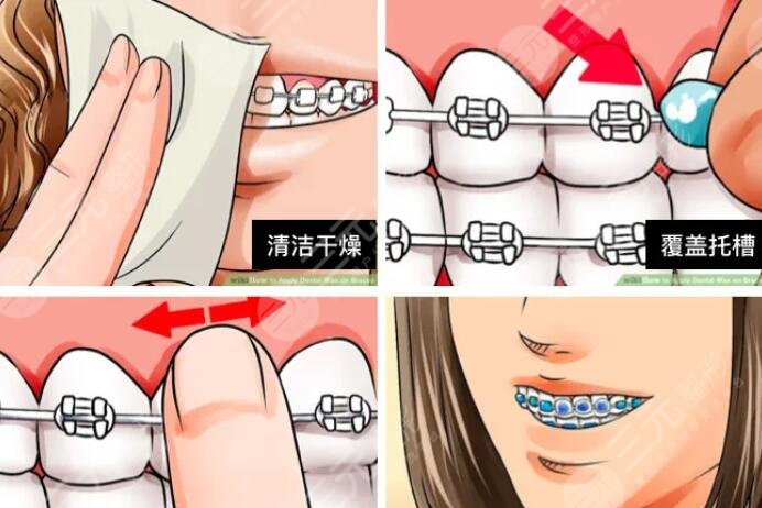 牙齿矫正前都需要做哪些检查