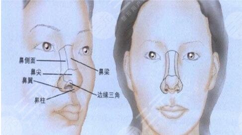 全肋隆鼻的适应症