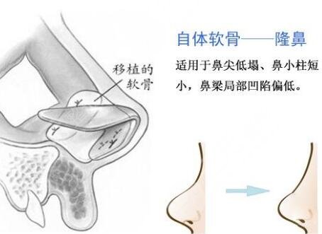 大连瑞和项目科普