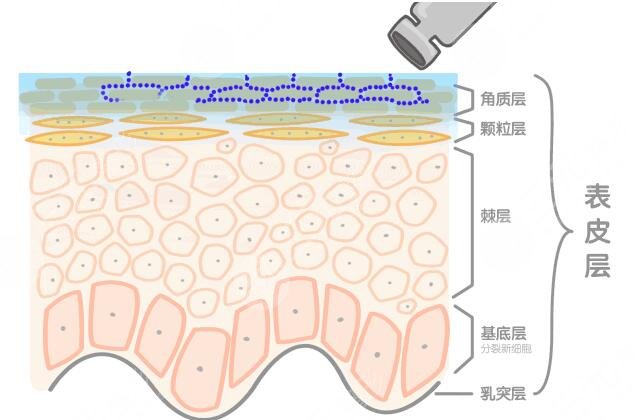 什么是热玛吉