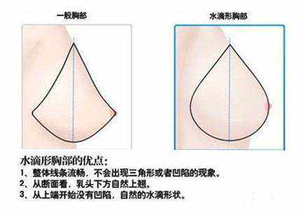 合肥壹加壹整形医院科普假体隆胸手术