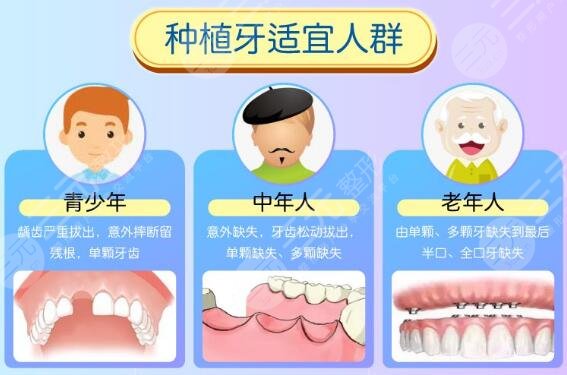 成都华*牙种植医院口腔科讲解