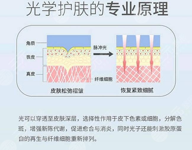 福建附属医院大学第一医院光子嫩肤案例