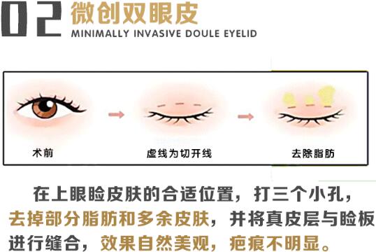 武汉蜜司医疗美容科普眼整形知识