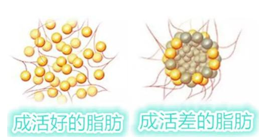 襄阳美嘉伊整形美容医院科普脂肪填充