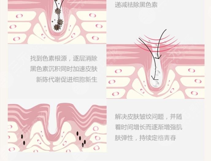 太原市中心医院点阵激光案例