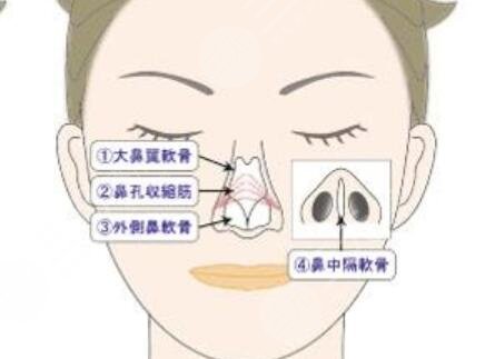 上海九院隆鼻手术后果