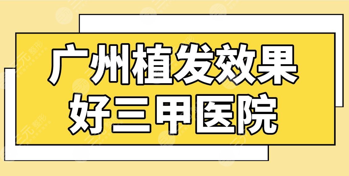 广州植发效果好三甲医院名单！南方医院和中山三院哪家植发更好？