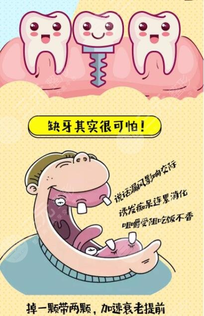 广州种植牙效果案例