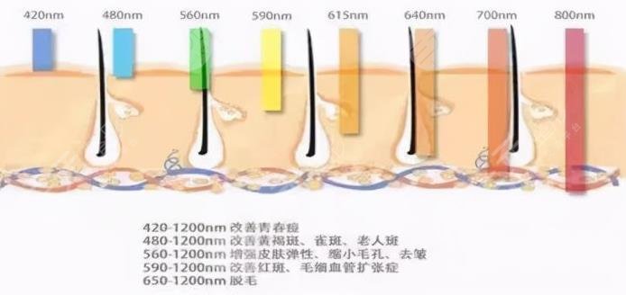 大连医科大学附属第一医院光子嫩肤案例