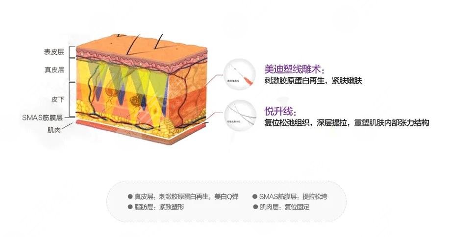 杭州薇琳医疗美容医院项目科普