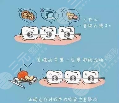 正畸饮食注意事项