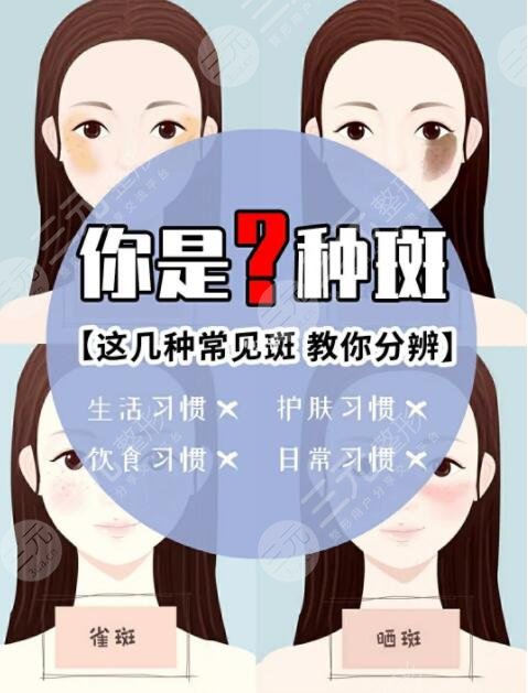 兰州祛斑美白手术项目案例体验反馈