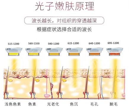 光子嫩肤原理