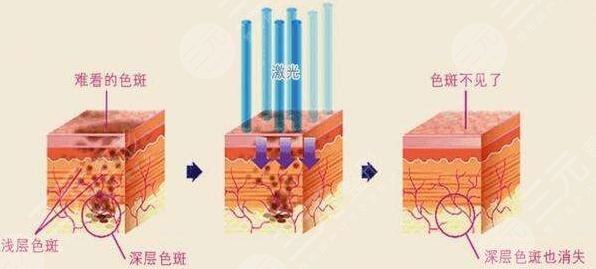 青岛华韩整形医院靠谱吗