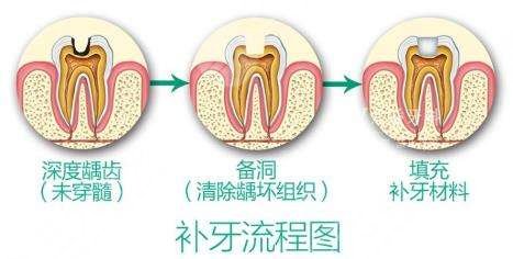 口腔保健重要性