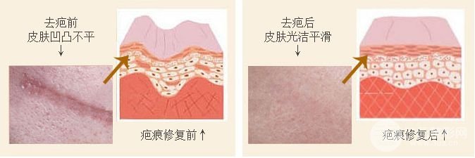 南通第三人民医院整形美容科技术好不好