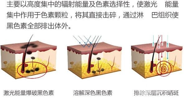 温州附一整形美容科祛痣果