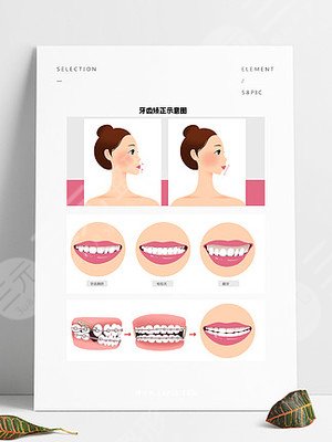 吉林市第二口腔医院牙齿矫正经历分享