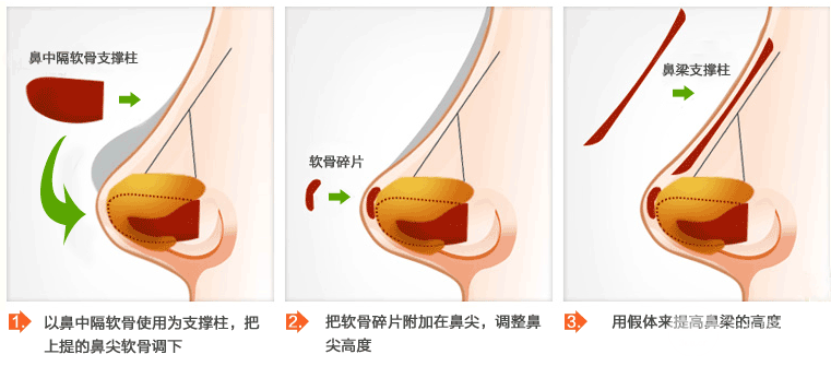 山东省立医院整形美容科价格表(目)|三甲医院整形专家坐诊一览