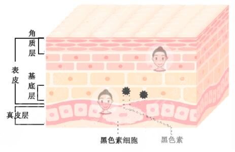 南宁激光祛斑真人案例