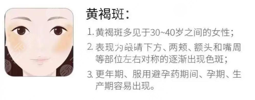 激光祛黄褐斑手术操作方式