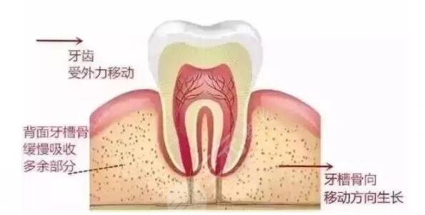 温州做种植牙真人案例