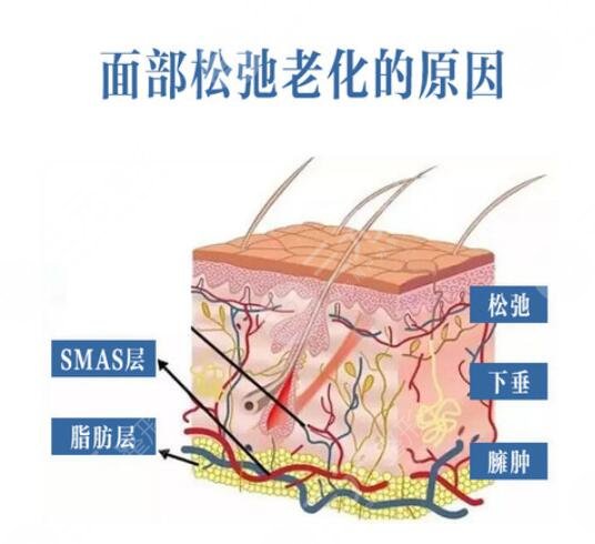 面部除皱抗衰的价格是多少?